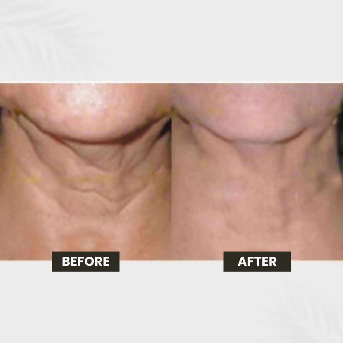 Visible Vessels transformation result