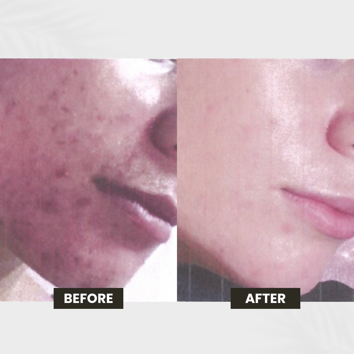 Sensitive Skin transformation result