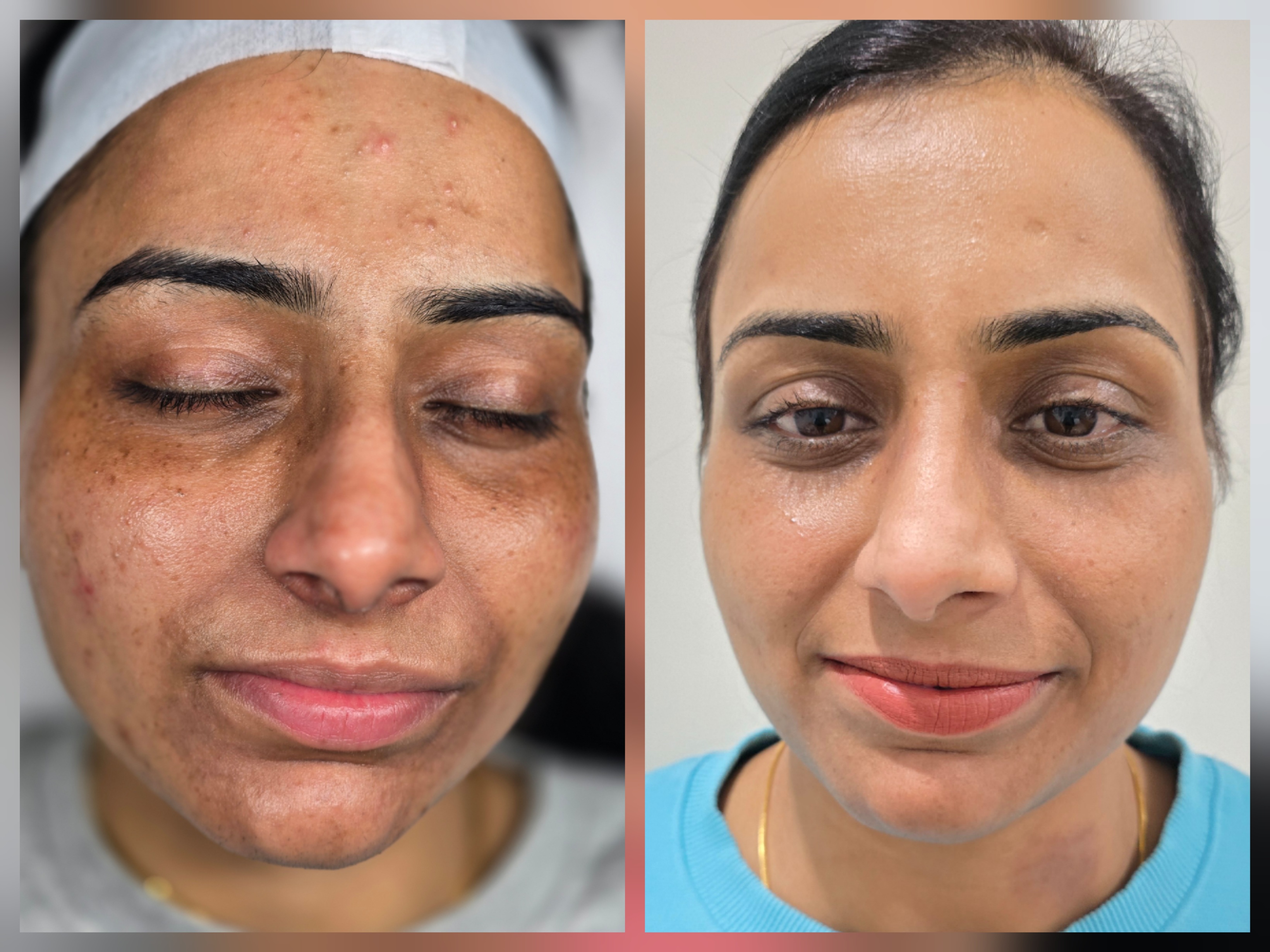 Client transformation result 1