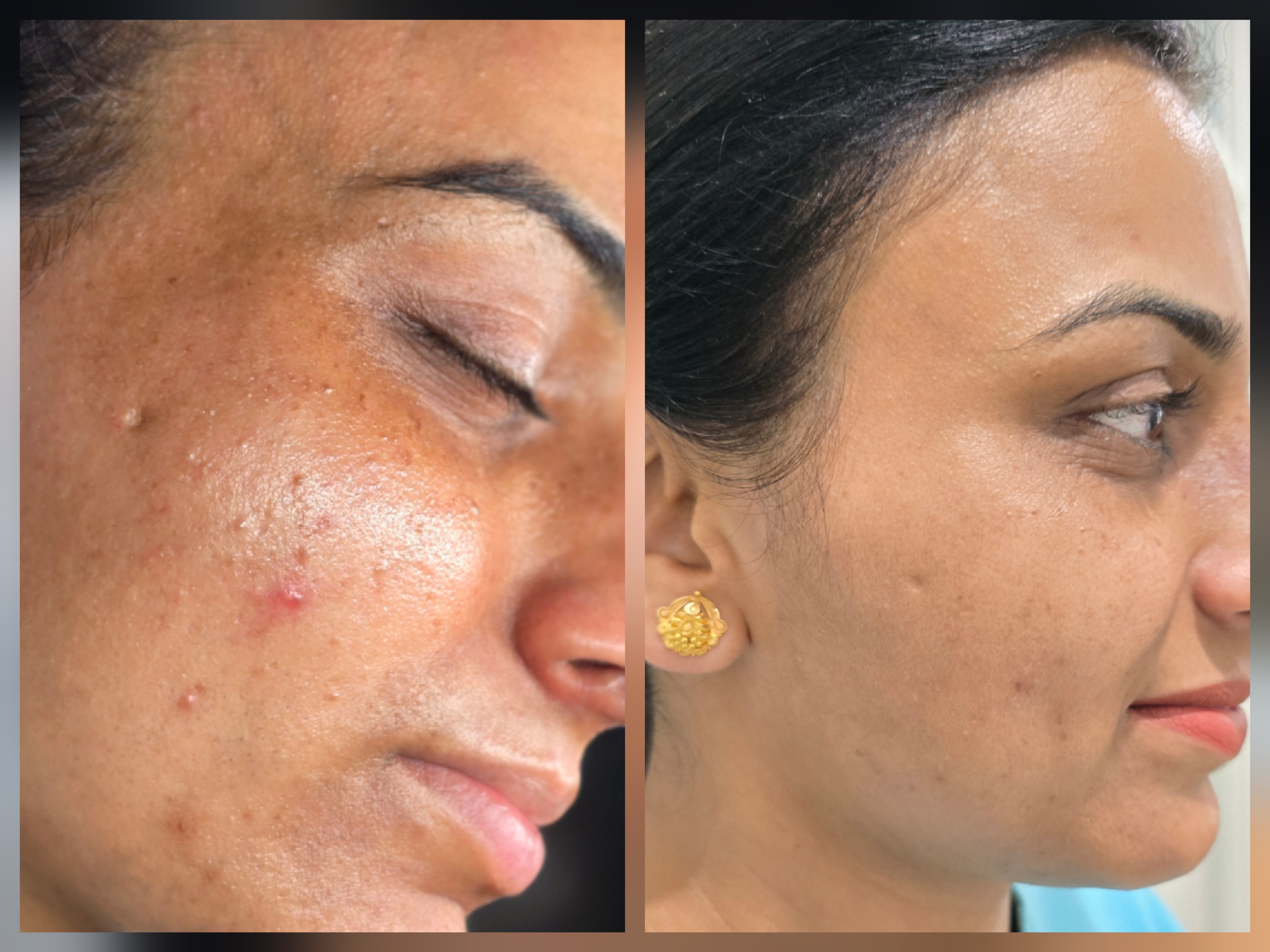 Client transformation result 2
