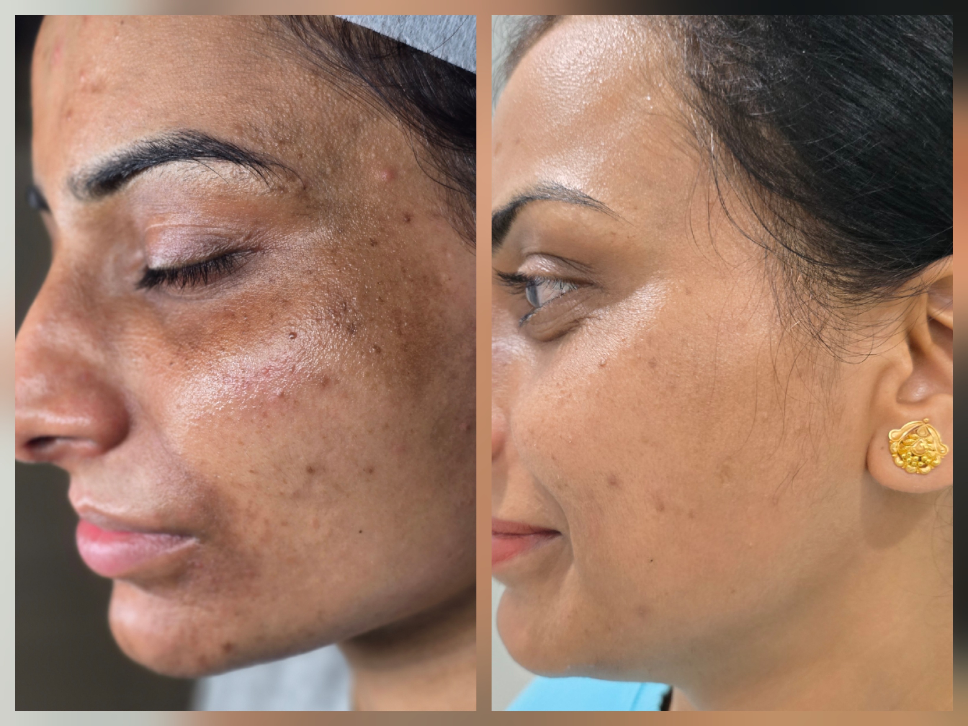 Client transformation result 3