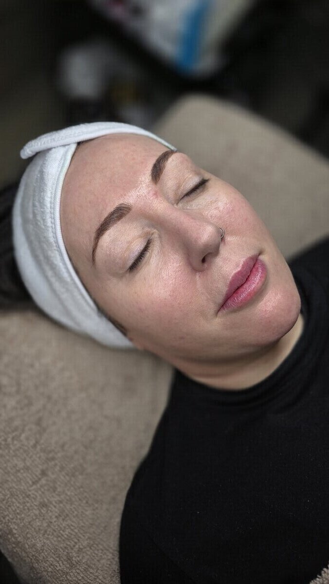 Hydrafacial treatment at Omni Skin Clinic