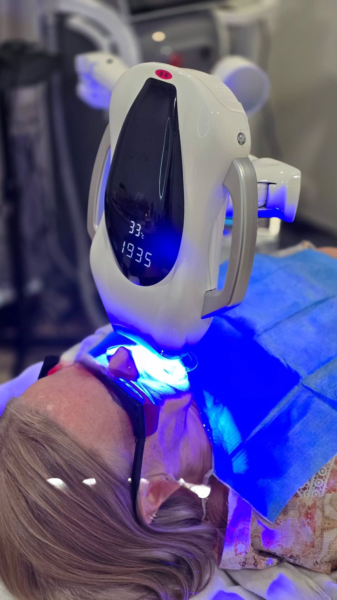 Teeth Whitening Results - Before and After at Omni Skin Clinic Brabham