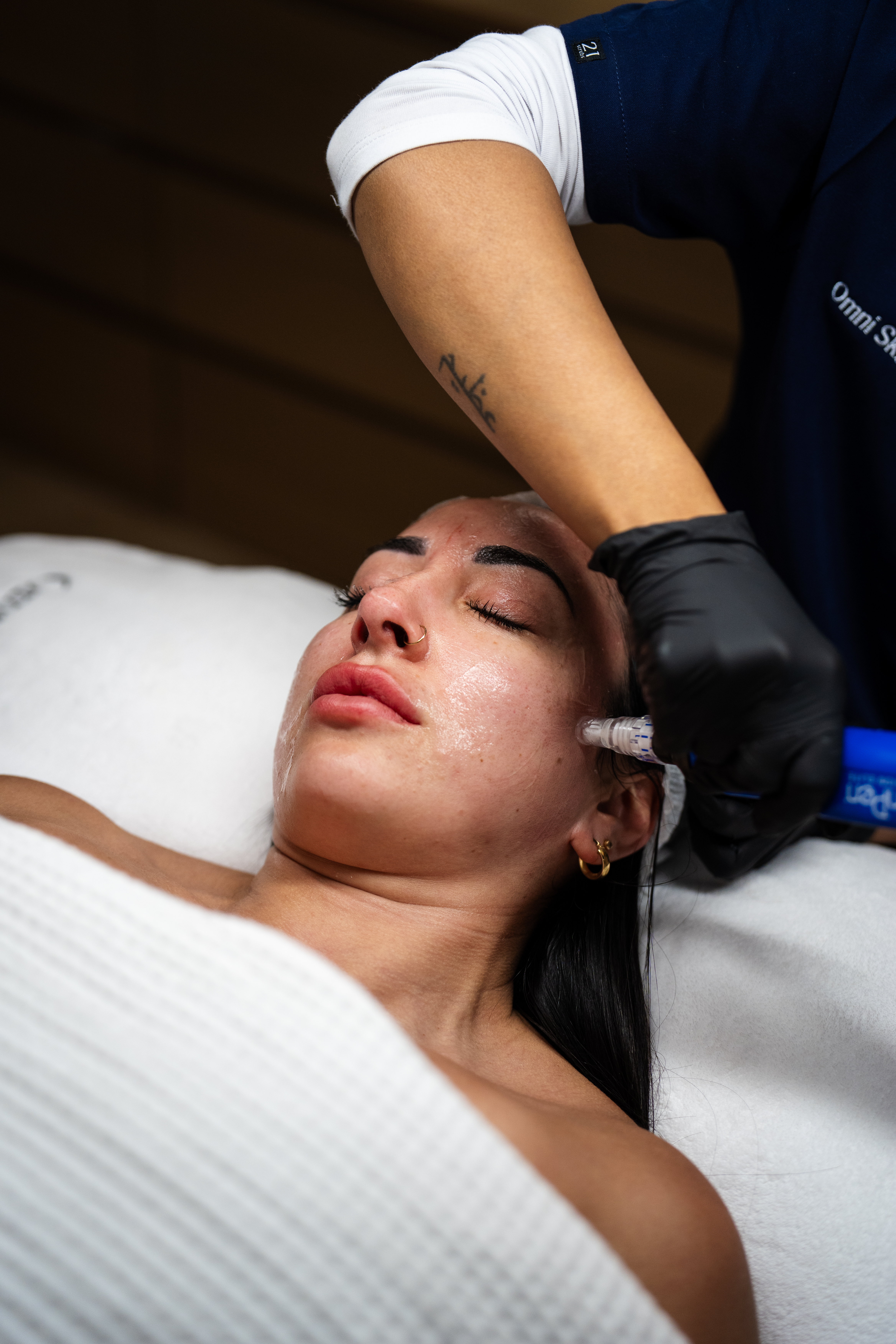 Microneedling treatment with the SkinPen Precision Elite at Omni Skin Clinic, Brabham